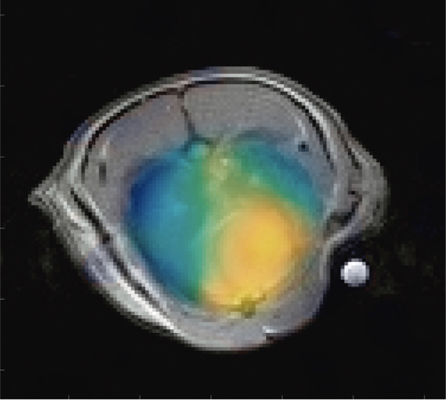 MRI Techniques